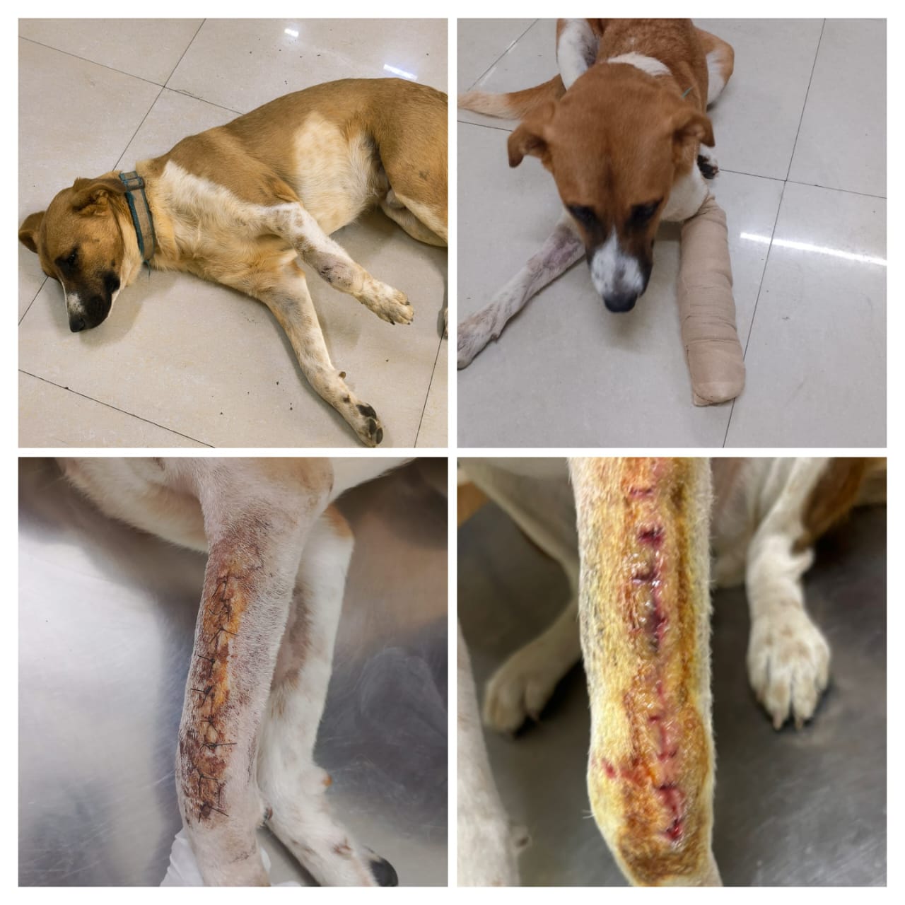 Skinny recovering after ortho surgery — bandaged leg and stitches